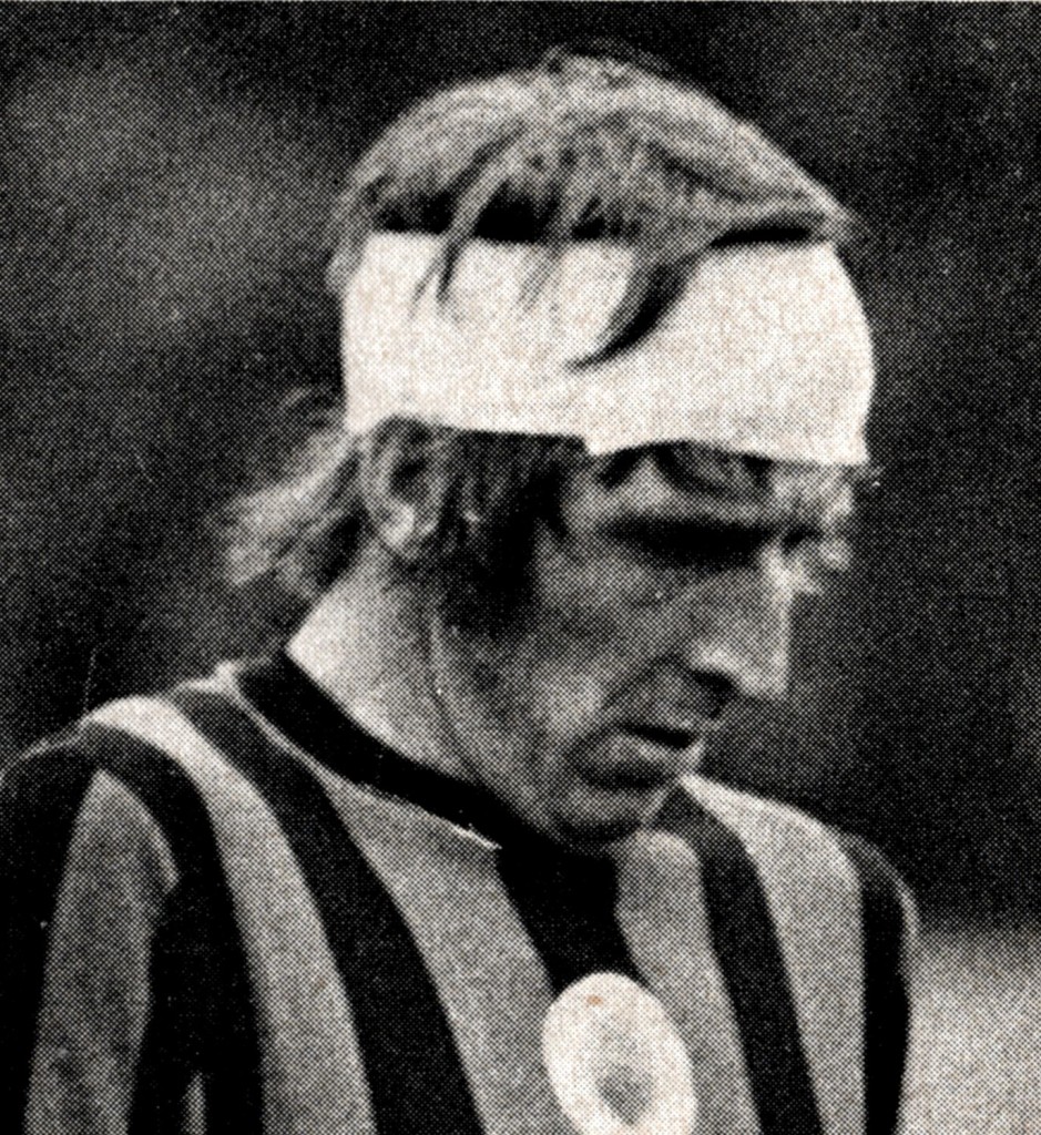 chelsea away 1971 to 72 davies head injury